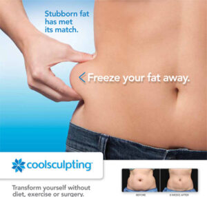 Cool Night Out with Coolsculpting