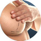breast augmentation circle image