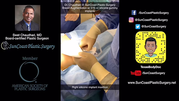A promotional image for SunCoast Plastic Surgery featuring plastic surgeon Dr. Swet Chaudhari. Center shows breast augmentation surgery with right silicone implant insertion; side panels highlight clinic and social media information.