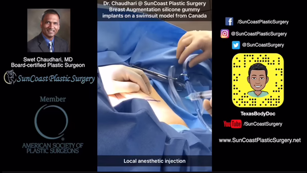 A SunCoast plastic surgeon performs a breast augmentation, injecting local anesthetic into the patient. The image features details about plastic surgery and displays SunCoast Plastic Surgery’s social media handles.