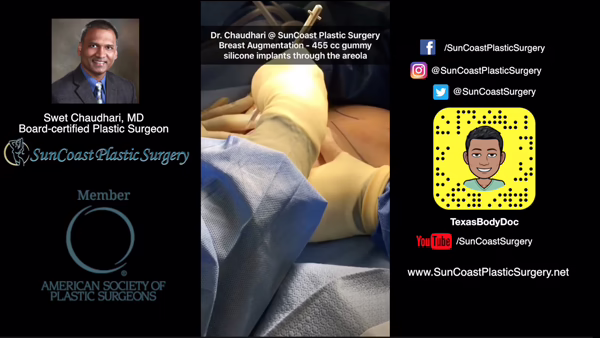 A collage featuring Dr. Chaudhari’s portrait, his credentials, SunCoast social media links, and a central image of the Houston surgeon performing breast augmentation on a patient.