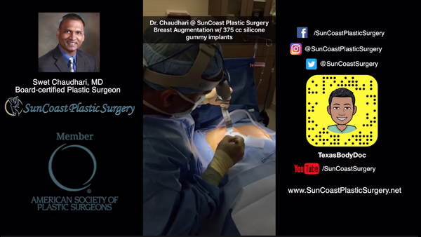 A graphic for SunCoast Plastic Surgery in Houston features plastic surgeon Dr. Swet Chaudhari performing breast augmentation, with social media links, the SunCoast logo, and Dr. Chaudhari’s photo and credentials included.
