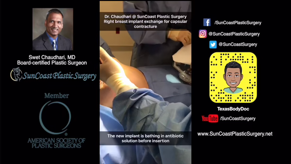 A Houston plastic surgeon in blue gloves prepares a breast implant for insertion, soaking it in antibiotic solution. Text and graphics promote Dr. Swet Chaudhari, Board-certified at SunCoast Plastic Surgery. Social media links are shown.