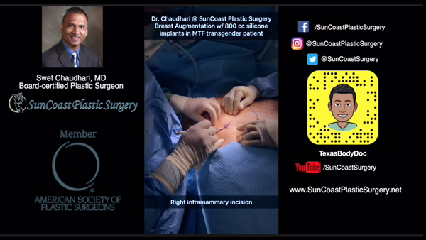 A graphic features Dr. Chaudhari, board-certified plastic surgeon at SunCoast, with social media handles. Center: hands performing breast augmentation with 800 cc silicone implants in an MTF transgender patient via inframammary incision.