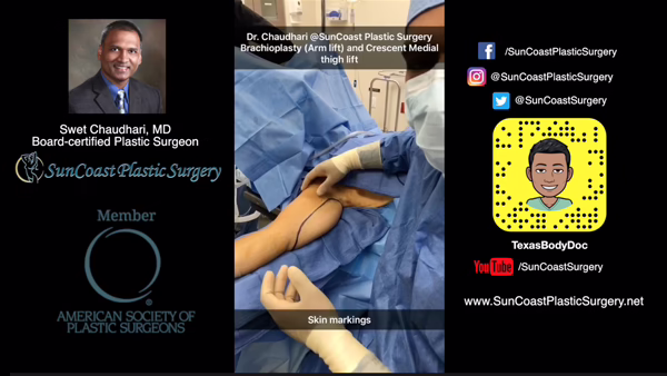 A Houston plastic surgeon in scrubs marks a patient’s arm for brachioplasty, with SunCoast Plastic Surgery’s logo and social media handles displayed on either side of the central image.