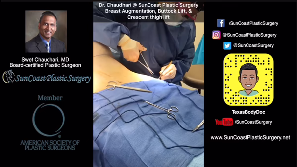 A Houston plastic surgeon wearing gloves performs a procedure on a patient in an operating room. The left side displays Dr. Swet Chaudhari’s photo, credentials, and social media info for SunCoast Plastic Surgery.